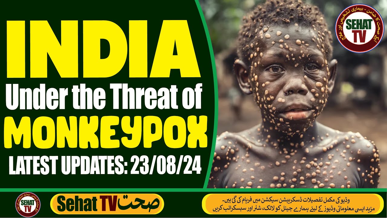 India Under Threat of Monkeypox | August 2024 Latest Updates & Insights ...