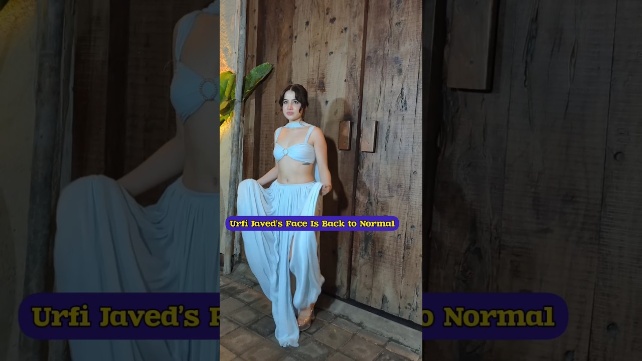 Uorfi Javed Face Is Back To a Normal After Lips Filler 