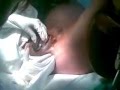 Vaginal Childbirth Delivery for woman