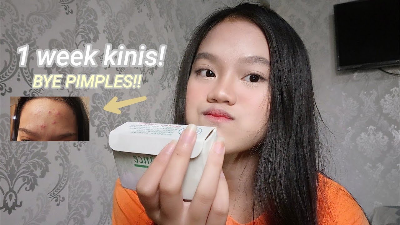 anti pimples soap review