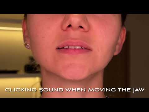 Video explaining the causes of jaw clicking sounds in TMJ patients