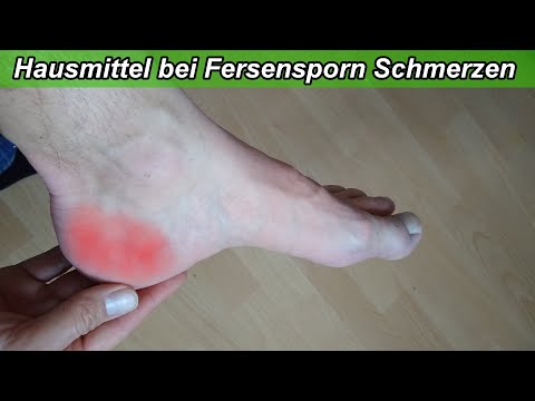 Fersensporn Hausmittel helfen den Schmerz zu lindern - Bei Fersenspor Schmerzen Essig & Backpulver