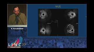 LINC 2025 Phoenix Atherectomy in Calcified CFA and Popliteal Artery Chronic Total Occlusions