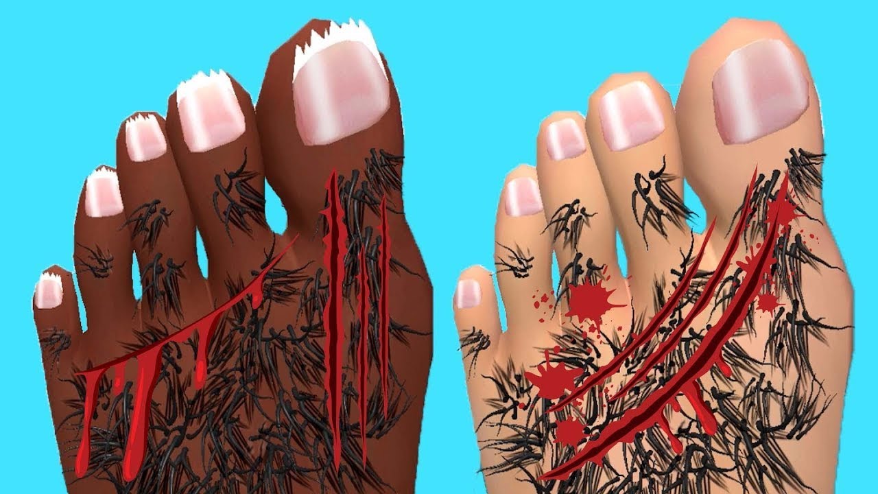 Foot Clinic - Gameplay Walkthrough - All Levels (IOS, Android)