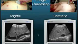 Emergency Ultrasound Course Lecture 1  Ultrasound Knobology by UCI