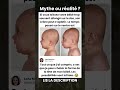 La Tête De Bébé Peut Rester Comme ça 