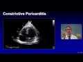 Treatment of Complicated Pericarditis