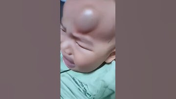 MIND-BLOWING Benefits of Adjustable Baby Helmets