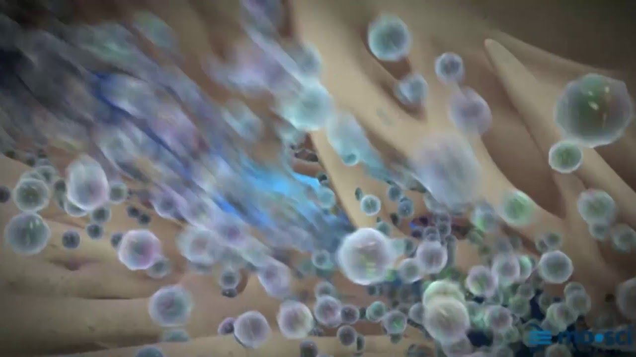 The Benefits of Bioactive Glass