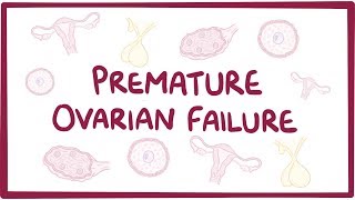 Premature ovarian failure - causes, symptoms, diagnosis, treatment,
pathology