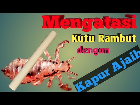 Cara Mengatasi Kutu Rambut dengan Kapur Ajaib | mudah dan cepat