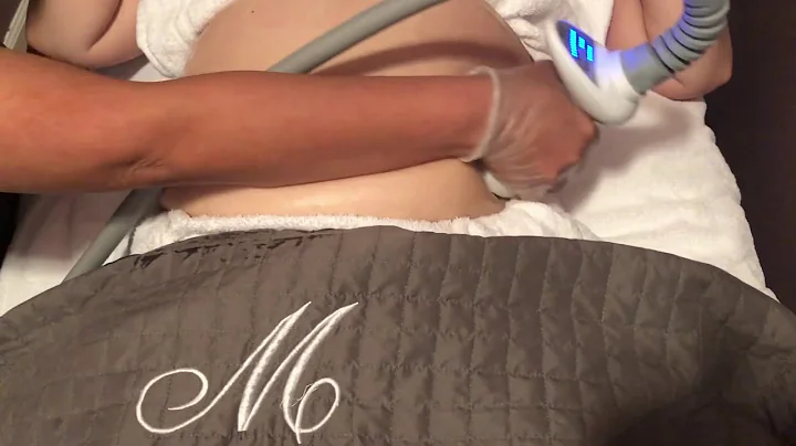 Venus Legacy Body Contouring.