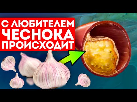 Как принять чеснок, чтобы: разжижать кровь, снижать холестерин, влиять на сердце, давление и...