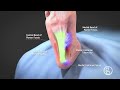 Plantar fascia release with microaire smartrelease  ghost productions medical animation