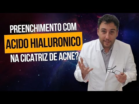 Vídeo: O ácido hialurônico causa acne?