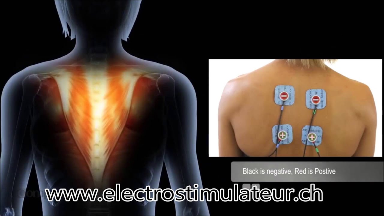 Placement et Position Electrode Compex Haut du Dos sur  Electrostimulateur.CH - YouTube