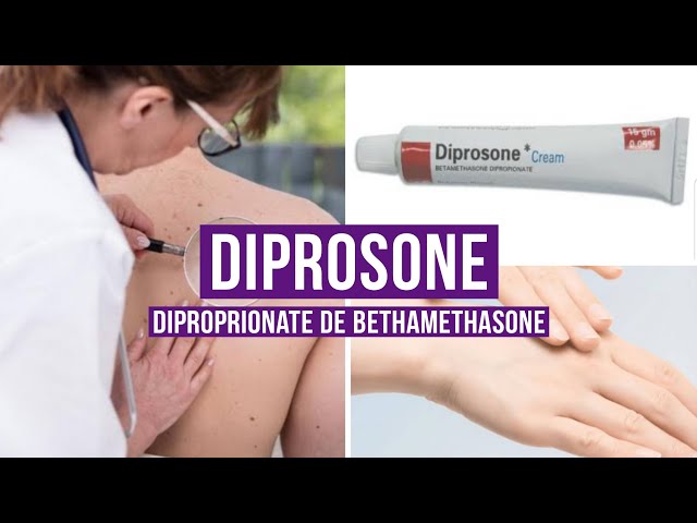 DIPROSONE (Dipropionate de bétaméthasone) - YouTube