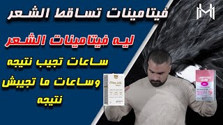 أفضل فيتامينات لعلاج تساقط الشعر