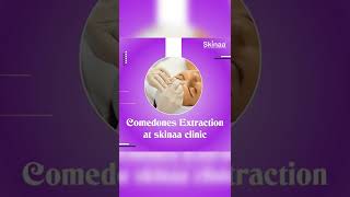 Here's A Quick Way To Solve The Comedones Extraction Problem | Viral #shorts