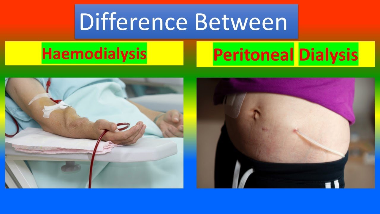 Difference Between Hemodialysis And Peritoneal Dialysis YouTube