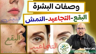 وصفات البشرة : النقط البنية والبقع - التجاعيد - النمش - الهالات السوداء / Wasafat imad mizab visage