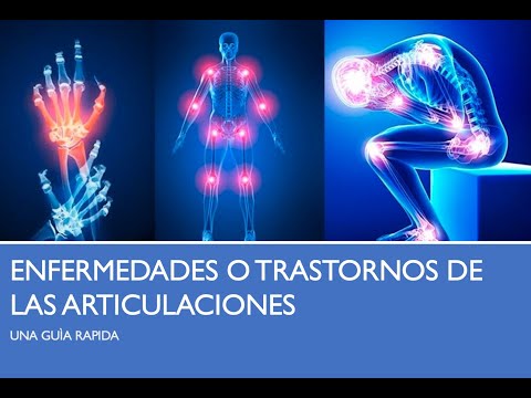 Vídeo: ¿Qué Causa Las Articulaciones Calientes?