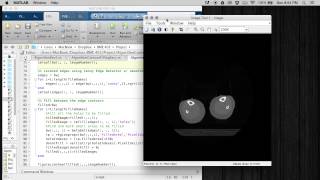 Famous Automatic Segmentation and Reconstruction Algorithm Wealth