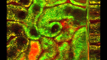 Visualization of Calcium Dynamics in Kidney Proximal Tubules