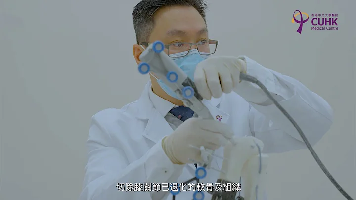 [醫生講場] 膝關節置換手術 | 患者分享 - 手術篇 (何其威醫生) Knee Replacement Patient Story - Surgery - 天天要聞