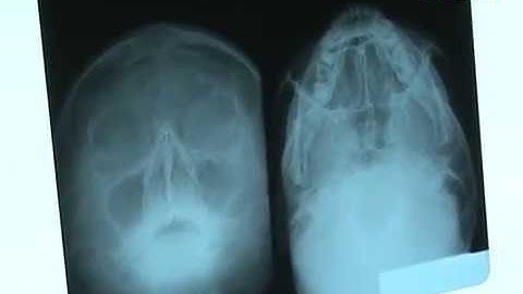 Thanh tra chuyên ngành về đo lường, an toàn bức xạ và hạt nhân năm 2016