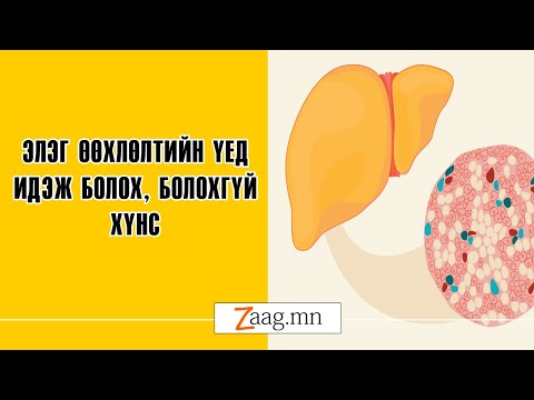 Видео: Элэгний гулзайлтын үед?