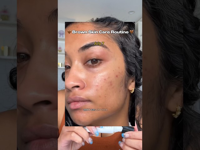 AD | THE #browngirlfriendly skincare routine that helped with my hyperpigmentation and acne ✨🫶🏽 class=