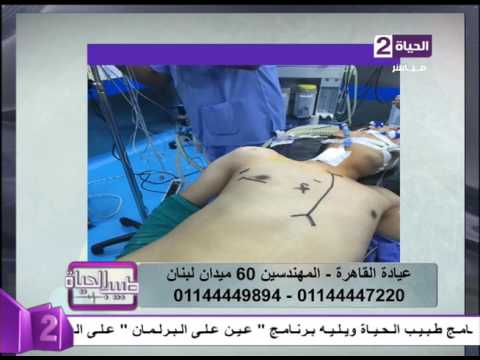 طبيب الحياة - أ.د/أحمد فؤاد أستاذ جراحة القلب - صور بعد عملية تغيير صمام  القلب بالمنظار - YouTube