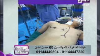 طبيب الحياة - أ.د/أحمد فؤاد أستاذ جراحة القلب - صور بعد عملية تغيير صمام القلب بالمنظار