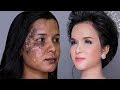 Da Lang Ben,Nám,Môi Thâm Đen Trang Điểm Sao Cho Đẹp?/ Hùng Việt Makeup