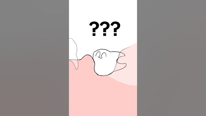 Wisdom teeth !!!!!!!!!!!!