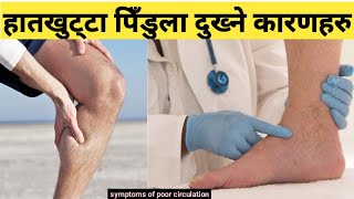 कमजोर रक्तसँचारमा देखापर्ने लक्षणहरू Symptoms and causes of poor circulation || Nepali Health Tips
