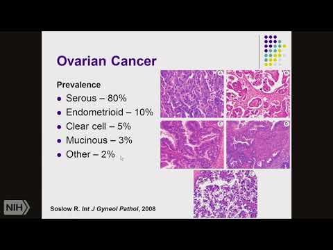 Video: Mye Metastatisk Glioblastom Med BRCA1 Og ARID1A Mutasjoner: En Saksrapport