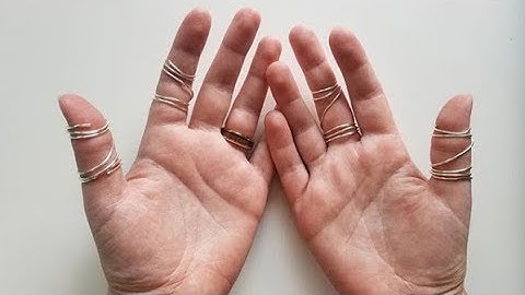 DIY Ring Splints