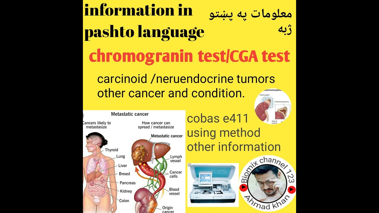 Chromogranin test /CGA test /biomarkers/tumor marker /in pashto - YouTube