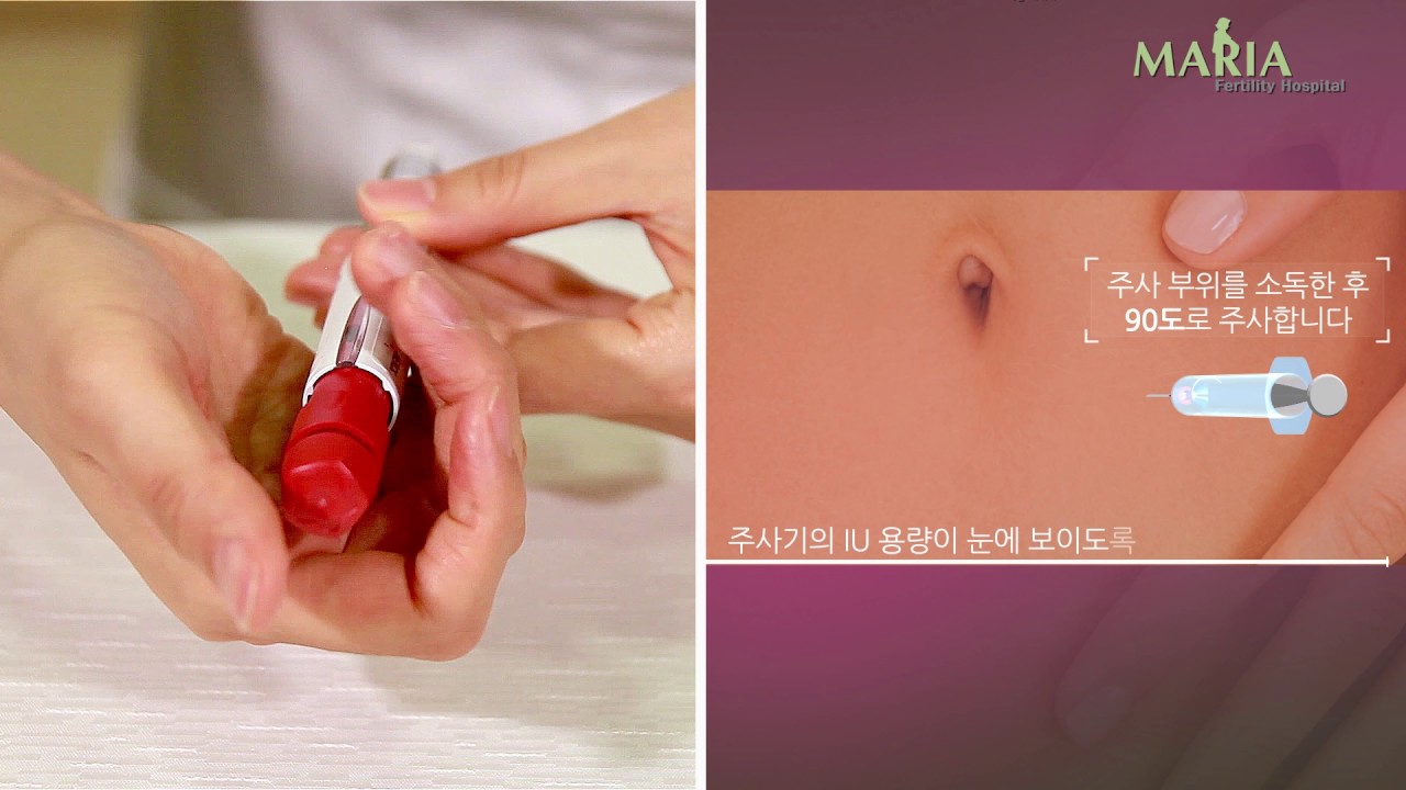 [난임일기] 시험관 1차 시작! / 서울역차병원 시험관 시술과정(배주사, 난자 채취, 복수, 5일 배아)