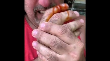What happens when you stick your fingers in a fan?