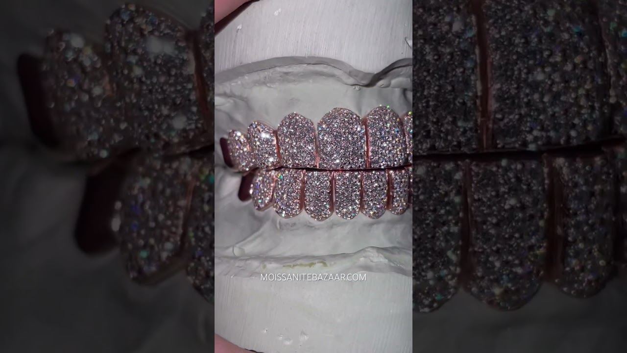 10 on 10 CAPPED VVS Moissanite Grillz in 925 Silver w/ Rose Gold Plating