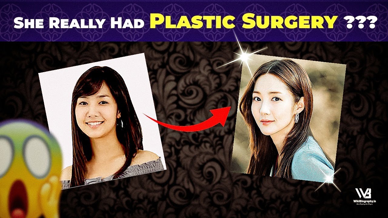 Park Min Young Went Through Plastic Surgery As She Thought She Was So Ordinary To Be An Actress