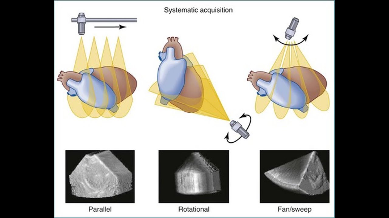 Практические советы и рекомендации по 3D-эхокардиографии на ультразвуковых системах Philips и GE.
