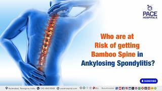 Who is at Risk of Developing Bamboo Spine in Ankylosing Spondylitis