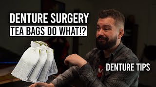 After Denture Surgery Instructions - Heal Safely and Fast