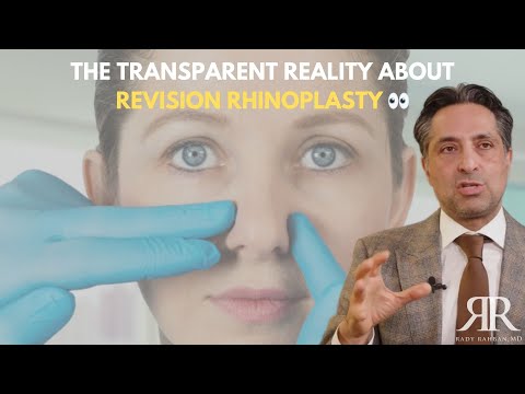 Video thumbnail: The Transparent Reality About Revision Rhinoplasty #plasticsurgery  #drrahban · Rady Rahban, MD