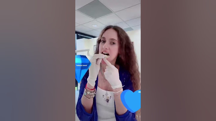 When the dentist gets a mold of her teeth!💎 #shorts #viral #teeth #youtubeshort