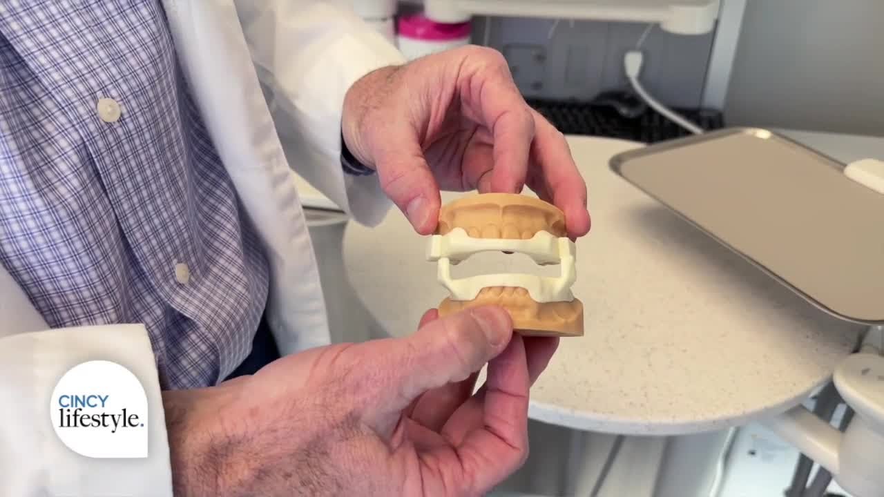 Understanding sleep apnea and oral appliance treatment | Cincy Lifestyle